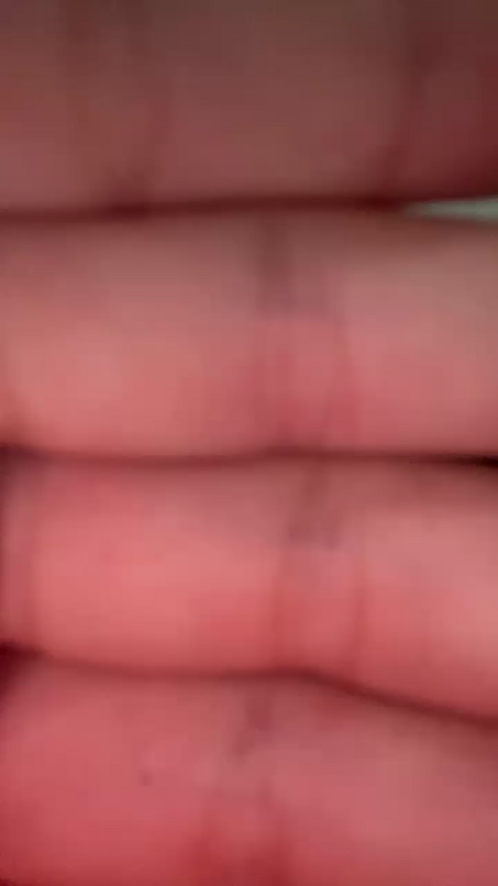 morugatita2