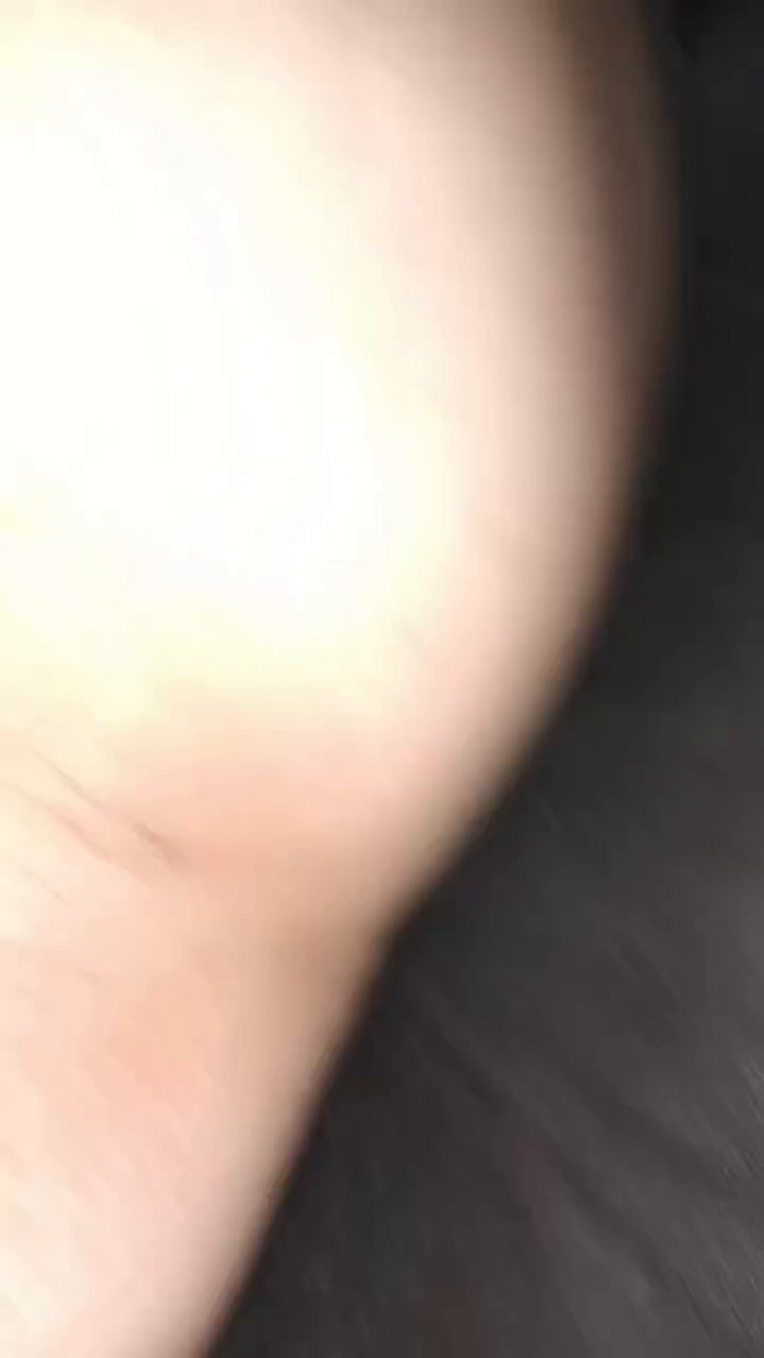 Aple82