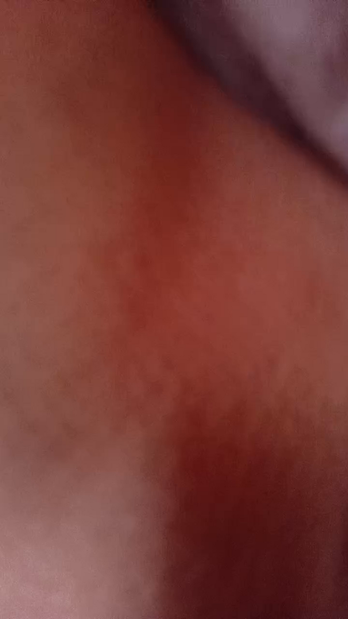 CasalMH