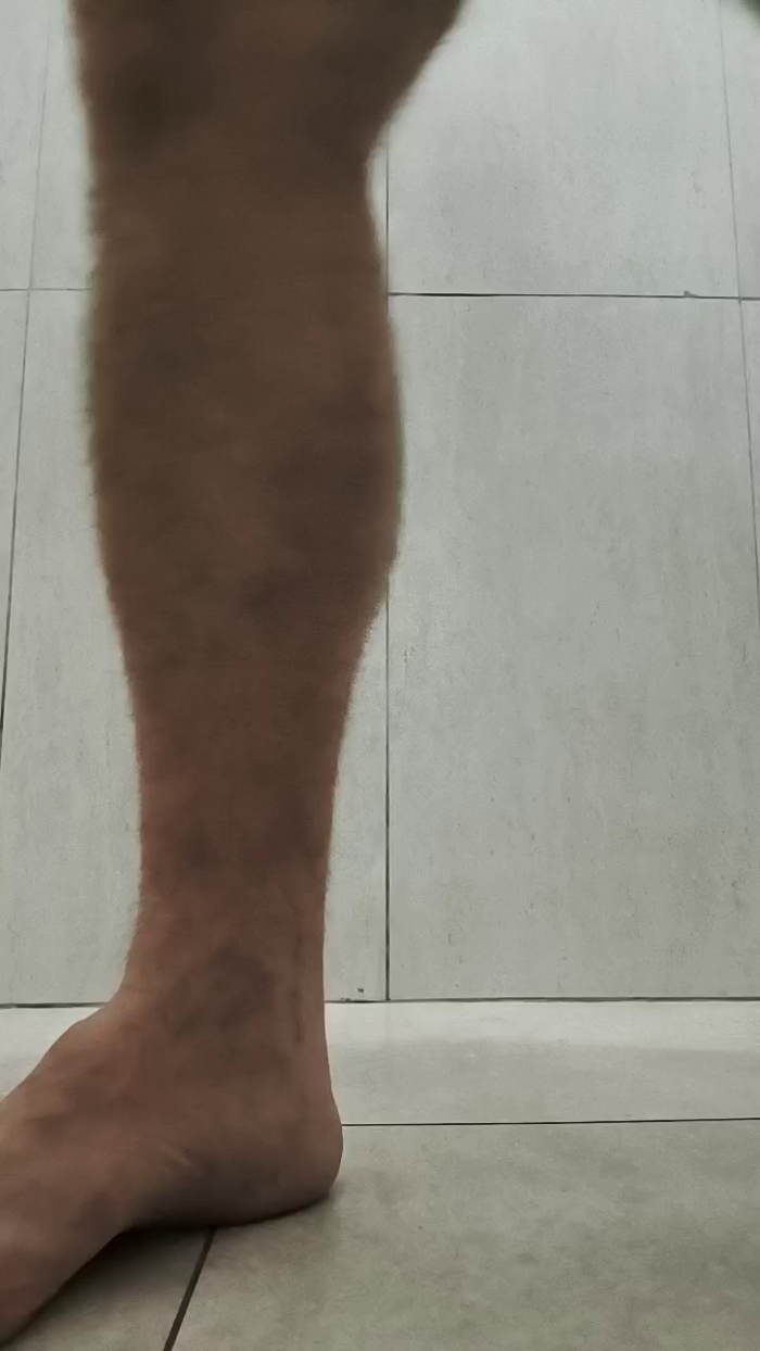 peludao3