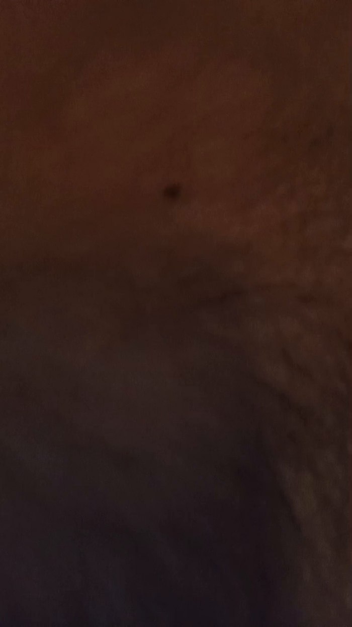 Billyytomy