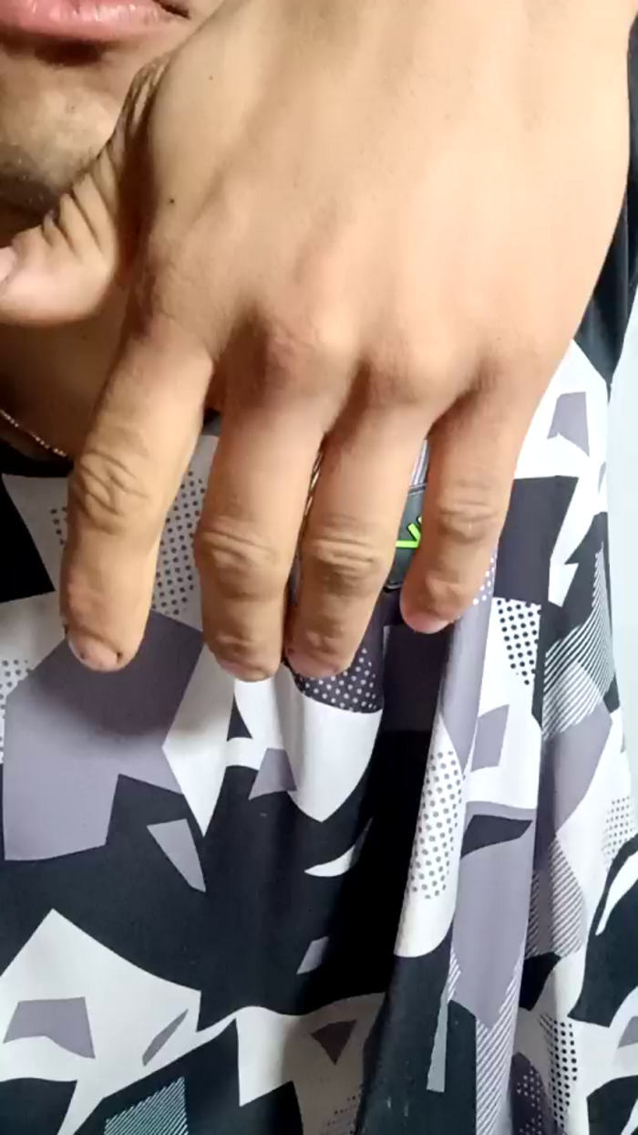 Oneballx