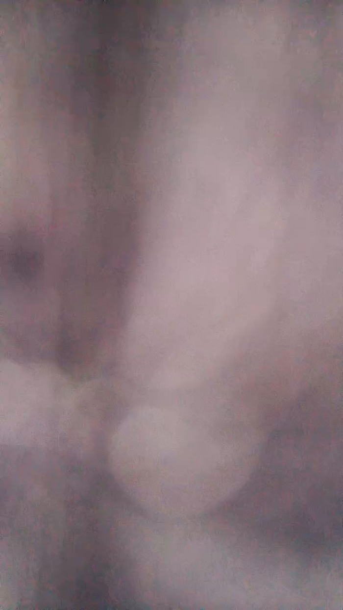 aera3