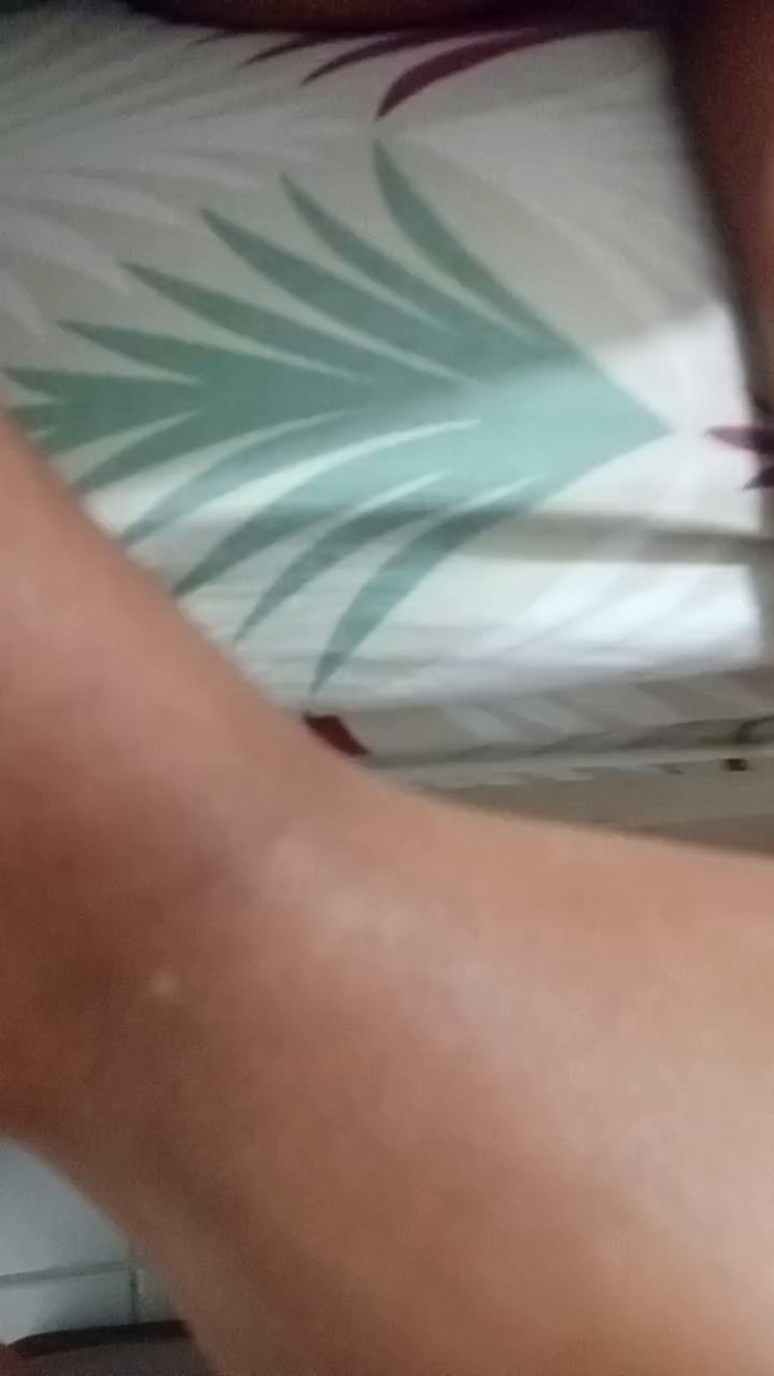 CasalMH
