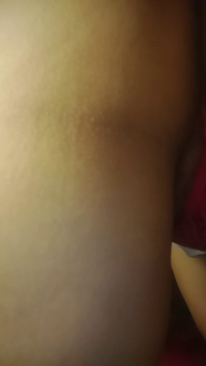 Morena_cacheado