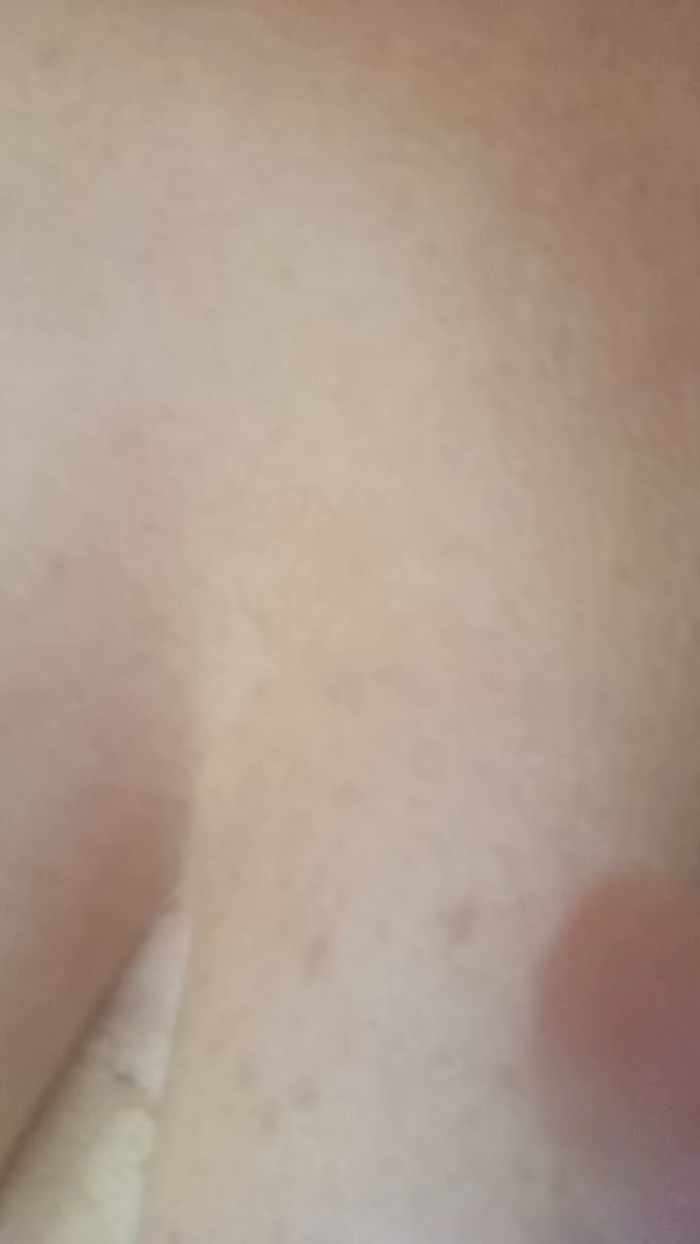 Scopami5