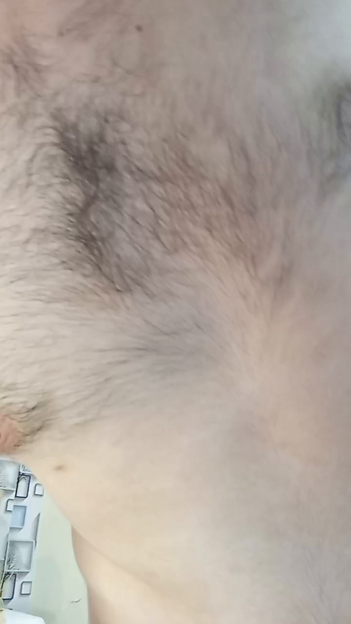 Billyytomy