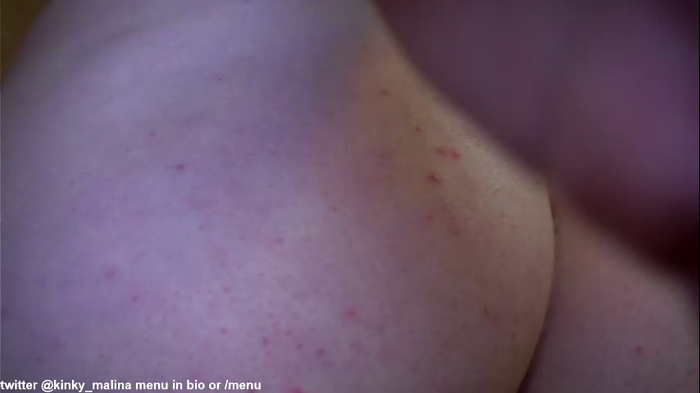 kinky_malina