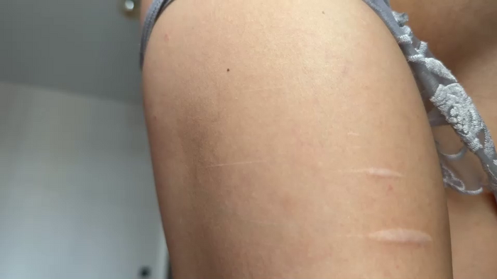 lesi_moonie