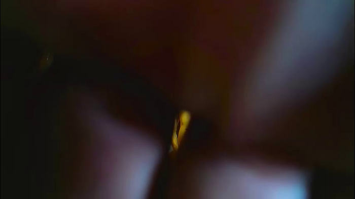 flyckers