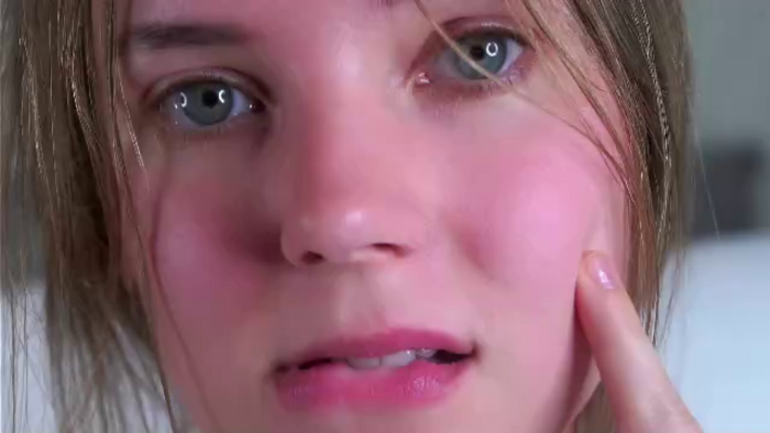 oda-mossey