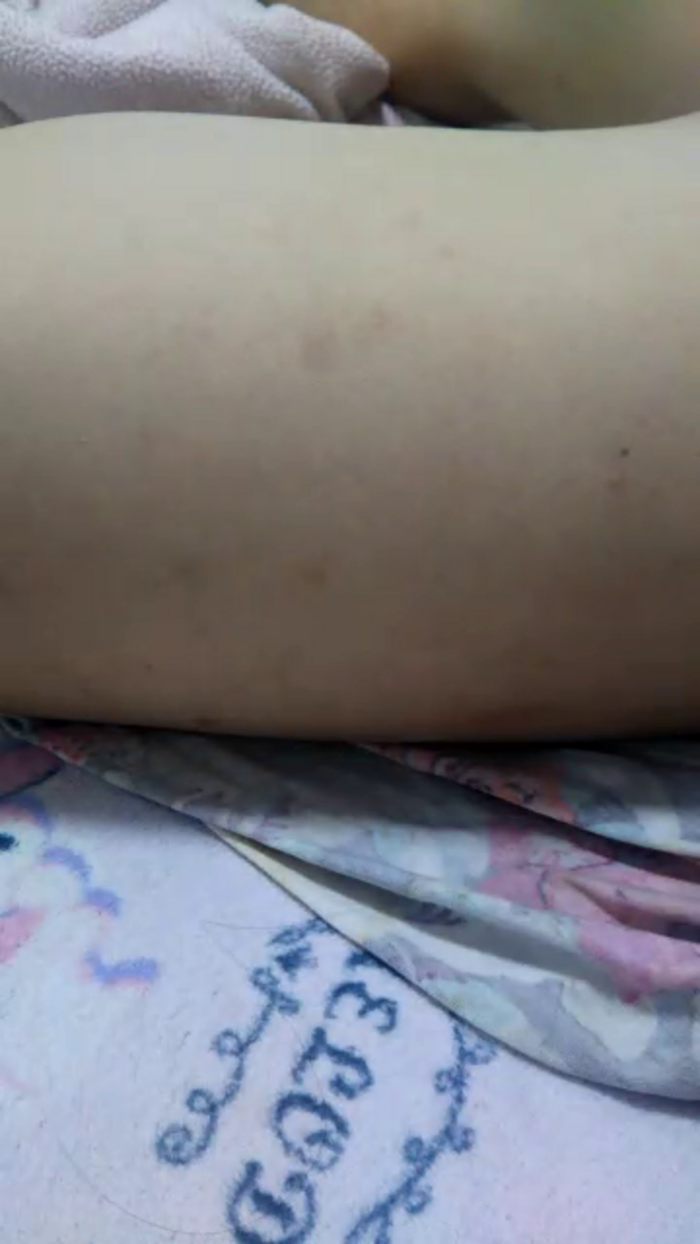 OhLady010
