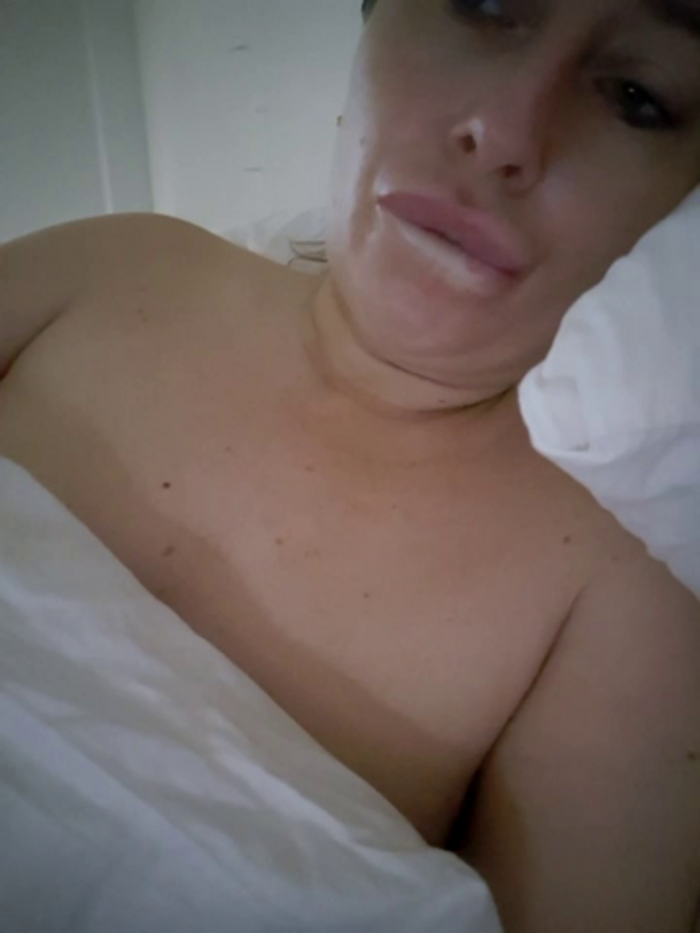 Molliexo