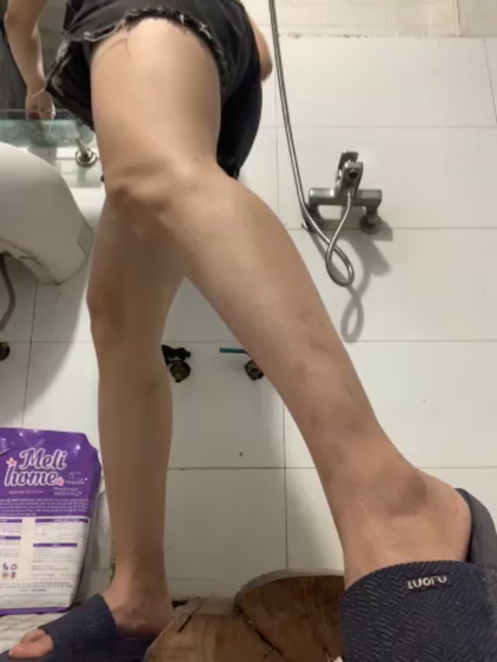 Any_224
