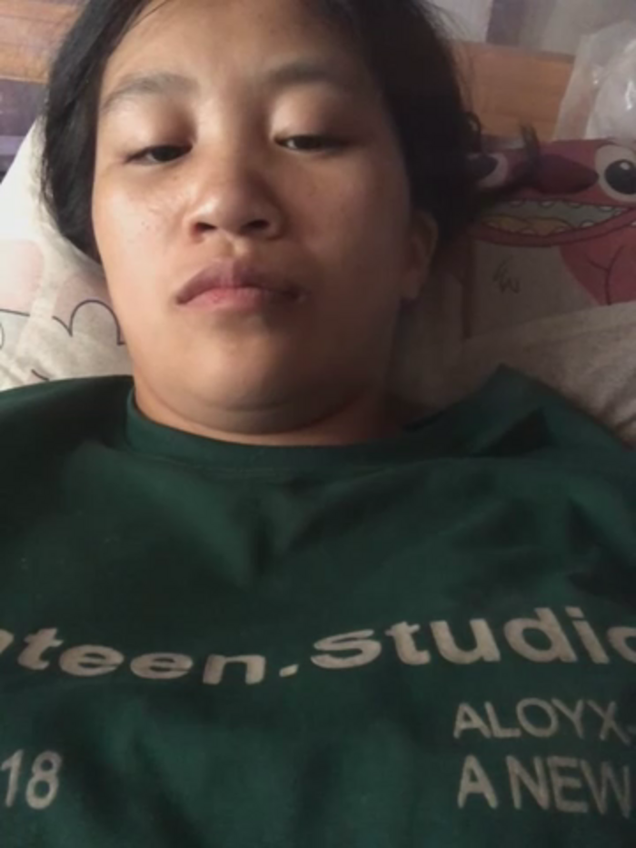 xotm