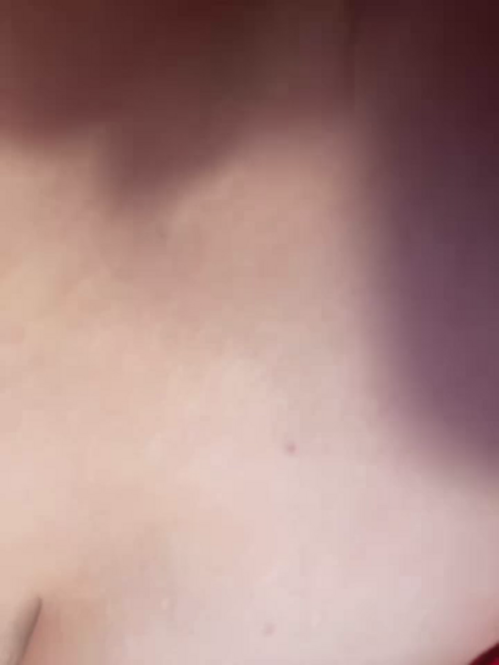 Apple-Boobs