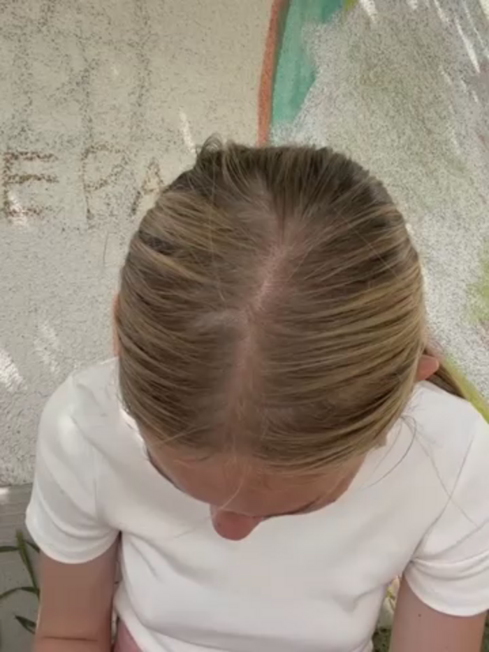 AnieMiller