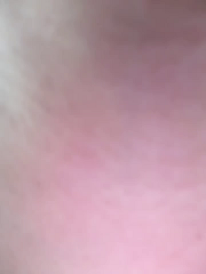 ateslidull