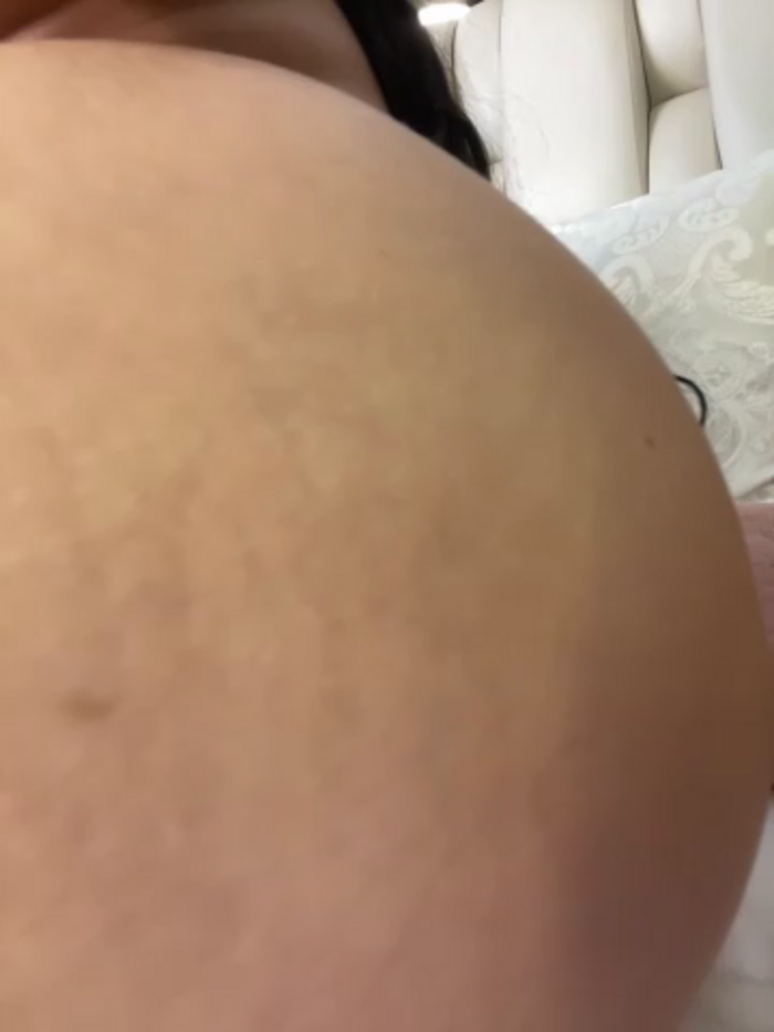 ALISSON_FOXXX1