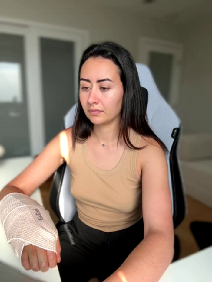 ximenacazalla