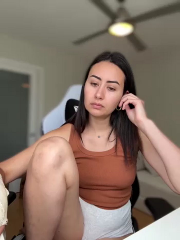 ximenacazalla